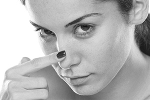 Rinoplastia na adolescÃªncia. Ã‰ indicada?